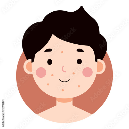 A cartoon illustration of a boy with acne on his face and a smile