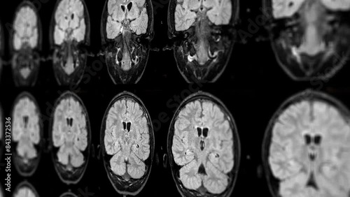 A series of brain scans are shown in a blue background. The scans are of different sizes and shapes, but all have a similar color and texture. Scene is one of curiosity and fascination