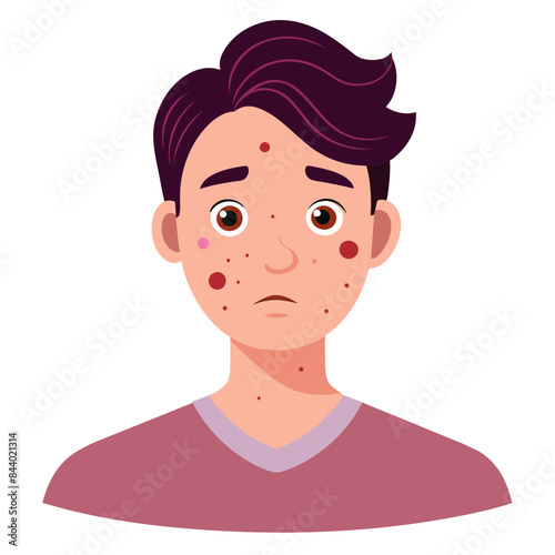 A young man with acne stands out in the crowd, revealing imperfections