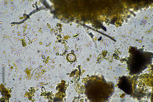 compost microorganisms under a microscope including amoeba, flagellates, nematodes, fungi, bacteria in spring photo