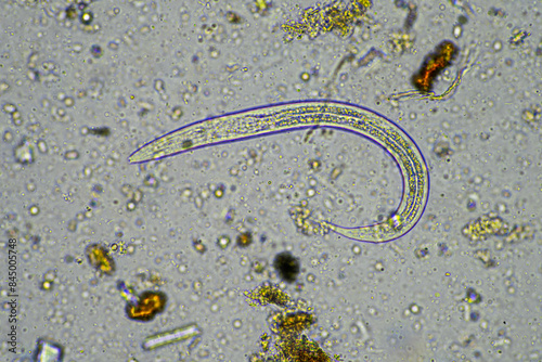 microorganisms under a microscope including amoeba, flagellates, nematodes, fungi, bacteria, viruses and diseases of animal and human health photo