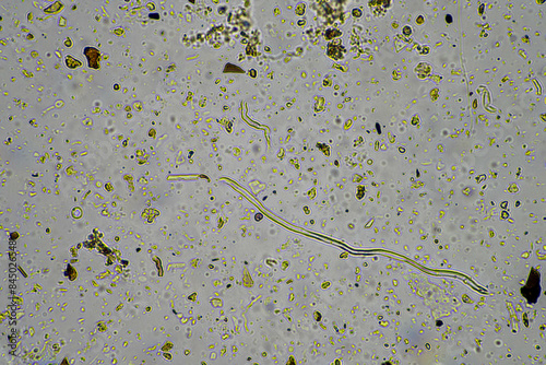 soil microorganisms under a microscope including amoeba, flagellates, nematodes, fungi, bacteria, from a soil sample on a regenerative agriculture farm in Australia photo