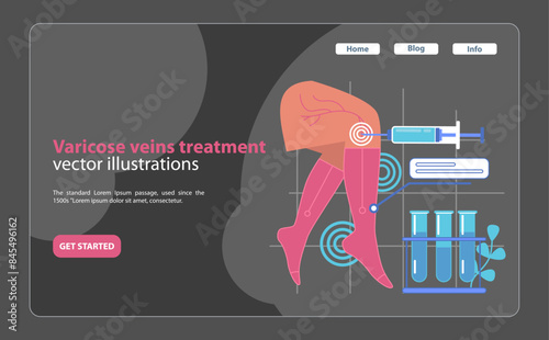 Specialized varicose veins treatment. A medical illustration depicting.