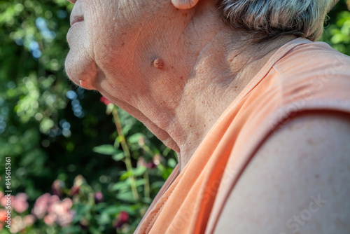 Loose skin on the neck of an elderly woman photo