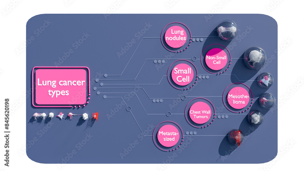 3D Cancer Cell Infographic, Lung Cancer Cells types in 3D style, Tumor ...