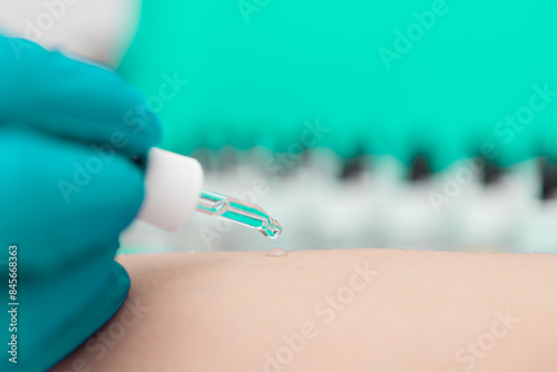 Macro shot of an allergy test on the skin of a patient.