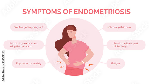 Endometriosis symptoms. Women uterine endometrial disease symptom diagnosis medical infographic banner, menstruation pain womb treatment healthy gynecology vector illustration