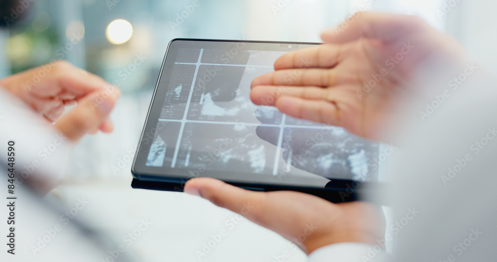 Doctor, hands and x ray with tablet screen for discussion on medical results, exam or test at hospital. Closeup of healthcare employees or pediatrician with CT scan, MRI or technology for surgery Doctor, hands and x ray with tablet screen for discussion on medical results, exam or test at hospital. Closeup of healthcare employees or pediatrician with CT scan, MRI or technology for surgery