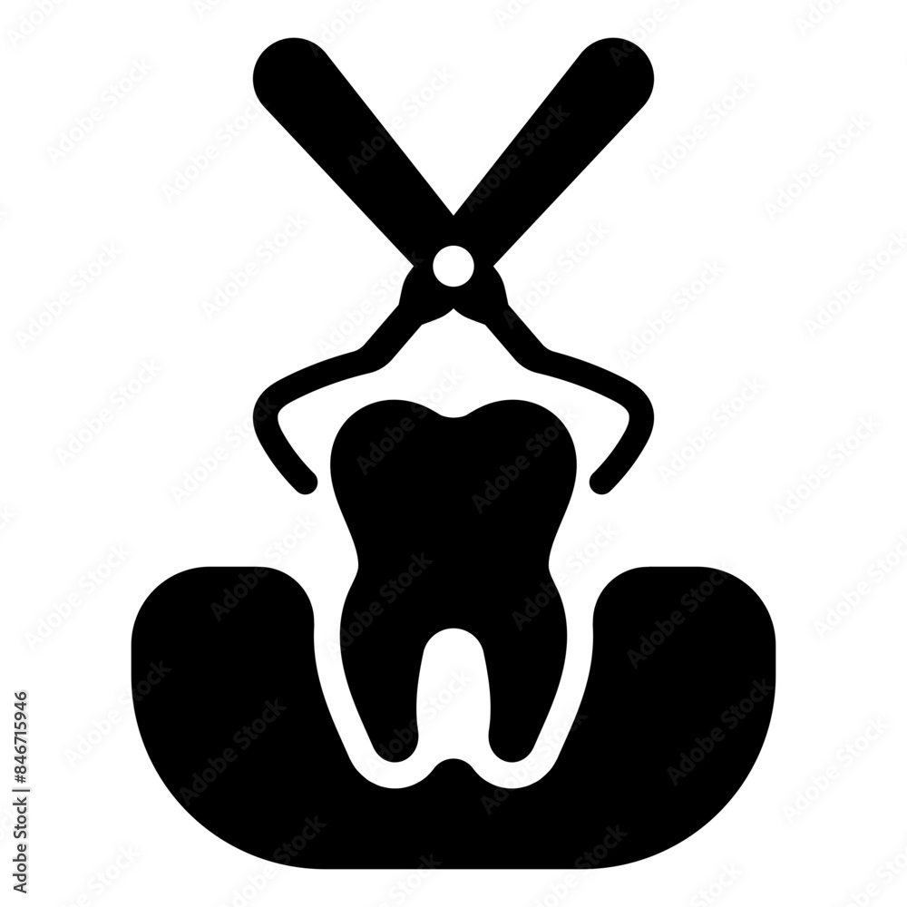 tooth extraction