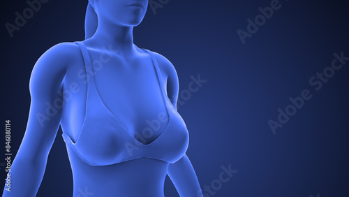 Medical animation of the Mastopexy or breast lift photo