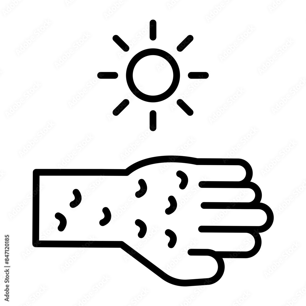 Sunburn Vector Line Icon Sunburn Vector Line Icon