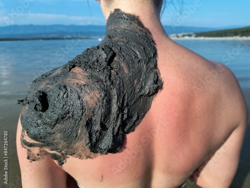 Woman with healing mud applied on back and shoulder, thalassotherapy and balneotherapy by  black peliod mud  at the beach Soline on the Island of Krk, Croatia