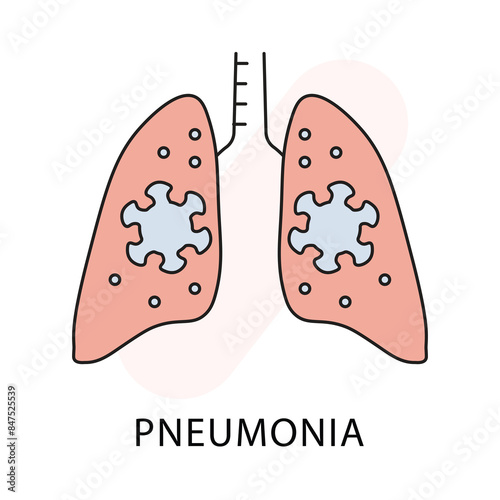 Detailed Pneumonia Icon - Medical Condition, Health, Respiratory Vector
Medical Illustration of Pneumonia - Health, Respiratory, Condition Icon with editable stroke.