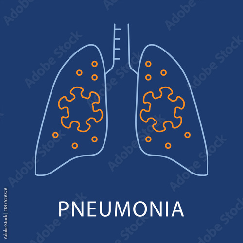 Detailed Pneumonia Icon - Medical Condition, Health, Respiratory Vector with editable stroke.