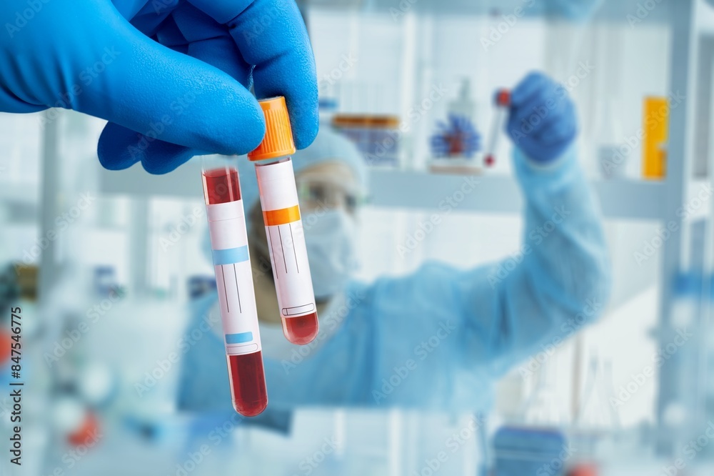 Hand hold test tube for blood sample Hand hold test tube for blood sample