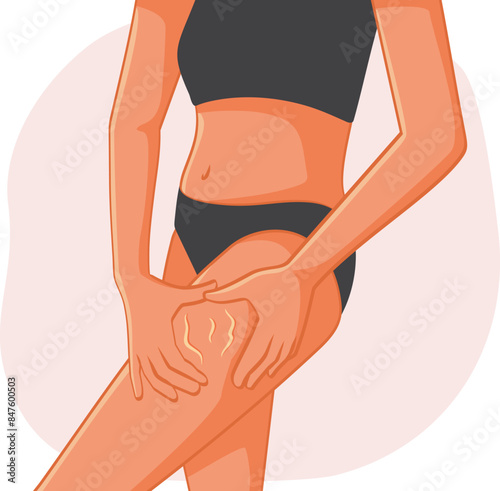 Woman Checking her Legs for Cellulite Vector Illustration. Insecure girl suffering from body dysmorphia from unrealistic beauty standards 
