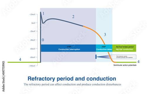 Impulse encounter effective refractory period will lead to conduction interruption, and encounter relative refractory period will lead to conduction delay.