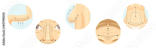 Plastic Surgery as Restoration and Reconstruction of Human Body Part in Circle Vector Set