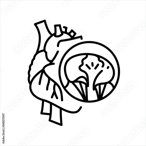 Mitral valve prolapse line black icon. Signs for web page