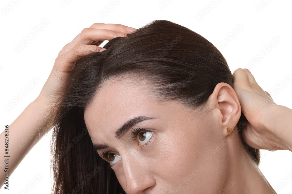 Young woman with hair loss problem on white background, closeup