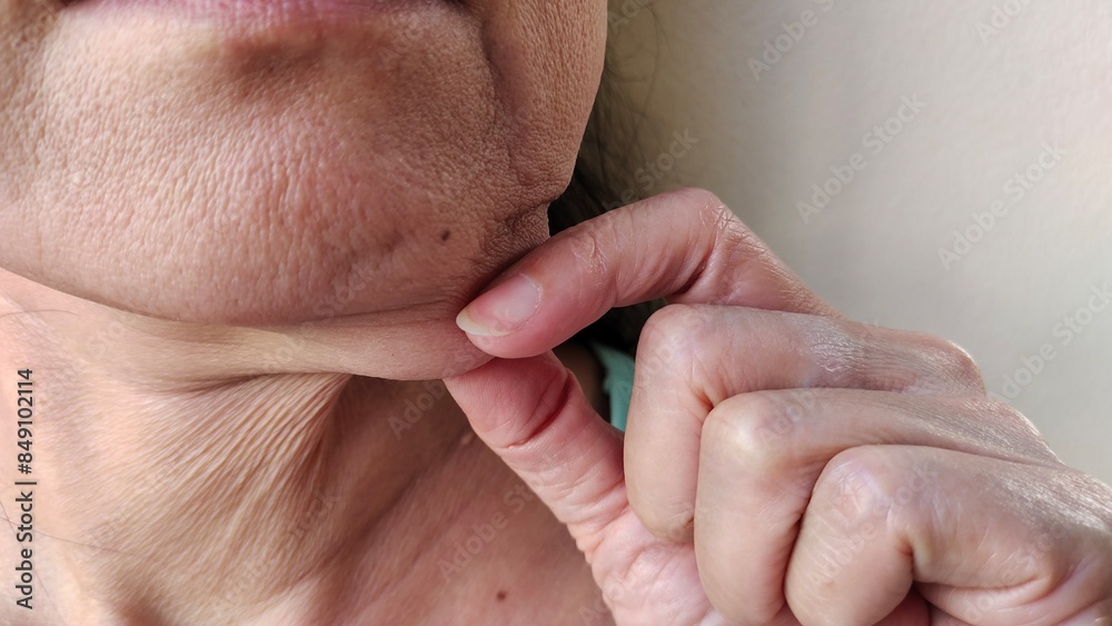 portrait the fingers squeezing the flabbiness adipose sagging skin, wrinkled and loose, Flabby skin and crease, cellulite under the neck of middle aged women 55 years old, health care and beauty. portrait the fingers squeezing the flabbiness adipose sagging skin, wrinkled and loose, Flabby skin and crease, cellulite under the neck of middle aged women 55 years old, health care and beauty.