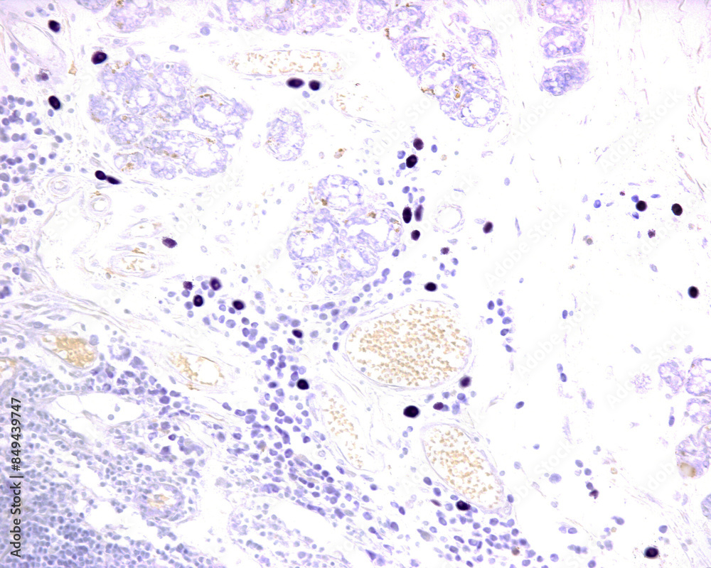 Obraz premium Mast cells