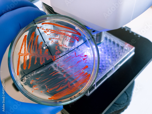 A petri dish with red colonies of bacteria against the background of a working microscope in the laboratory.