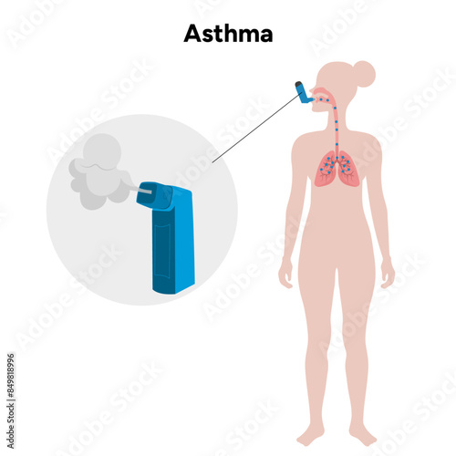 Lungs asthma in human and zoom inhaler