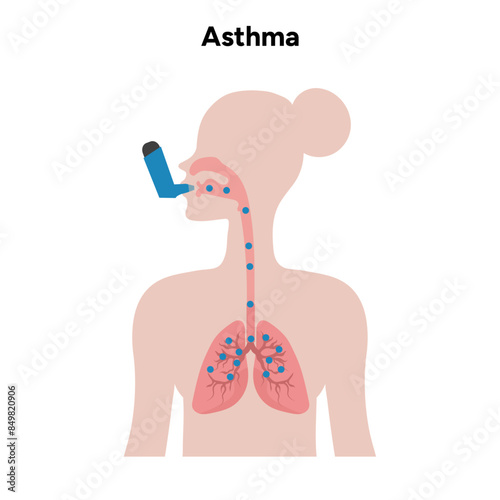 Lungs asthma in human zoom