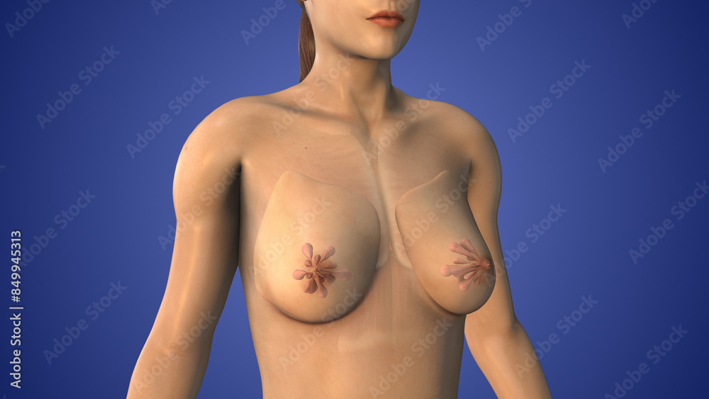 Mastopexy or Breast lift process Mastopexy or Breast lift process