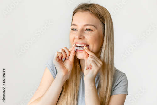 Dental care. Smiling woman with healthy teeth using removable clear braces aligner, orthodontic silicone trainer.