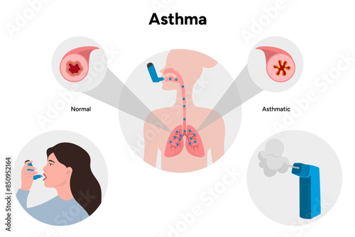 Asthmatic airways disease and inhaler with womans icon