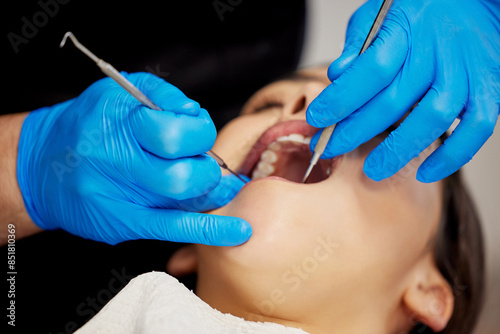 Dentist, patient and dental procedure for toothache in clinic, treatment and health for mouth. Teeth whitening, cleaning and person with medical equipment, oral care for inspection and orthodontics