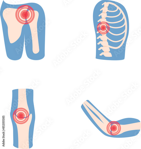 Joint inflammation icons set cartoon vector. Human joint with pain ring. Rheumatology, medicine