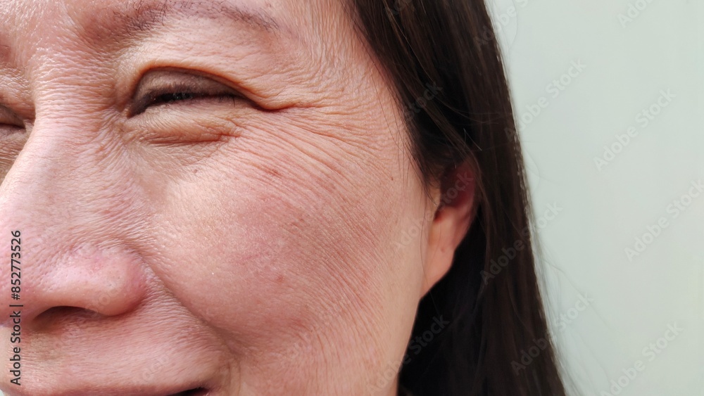 Obraz premium close up the Flabby skin and wrinkle beside the eyelid, swelling and ptosis, dark spots and blemish on the face of middle aged women, health care and beauty concept.