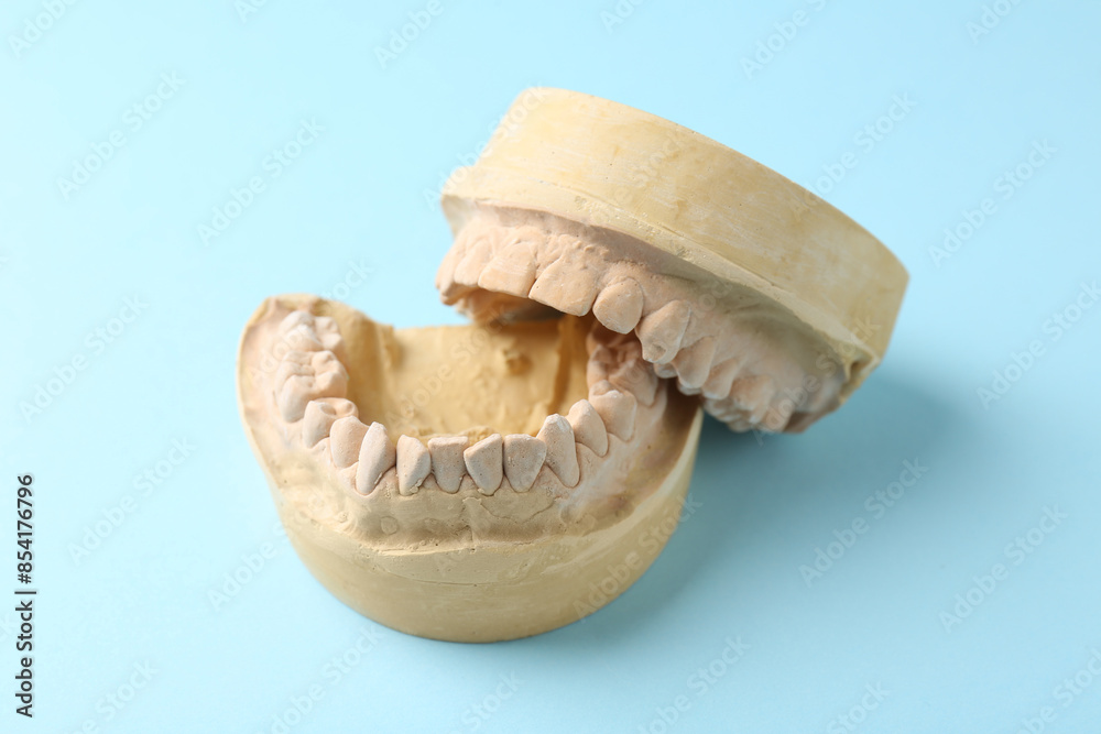 Dental model with gums on light blue background. Cast of teeth Dental model with gums on light blue background. Cast of teeth