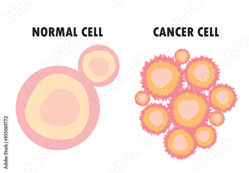Normal Cell vs Cancer Cell, Loss of normal growth control of cell , healthy tissue and tumor, vector illustration.