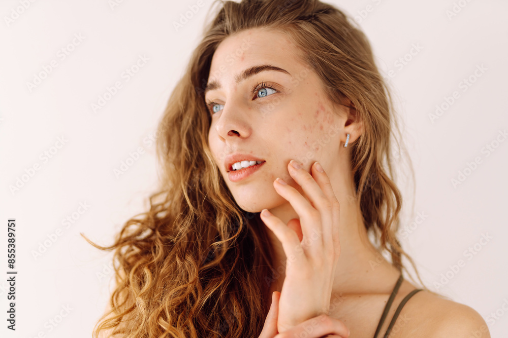 Woman no make up with red spots on her face. Health problem, skin diseases. Medicine and cosmetology concept. Woman no make up with red spots on her face. Health problem, skin diseases. Medicine and cosmetology concept.