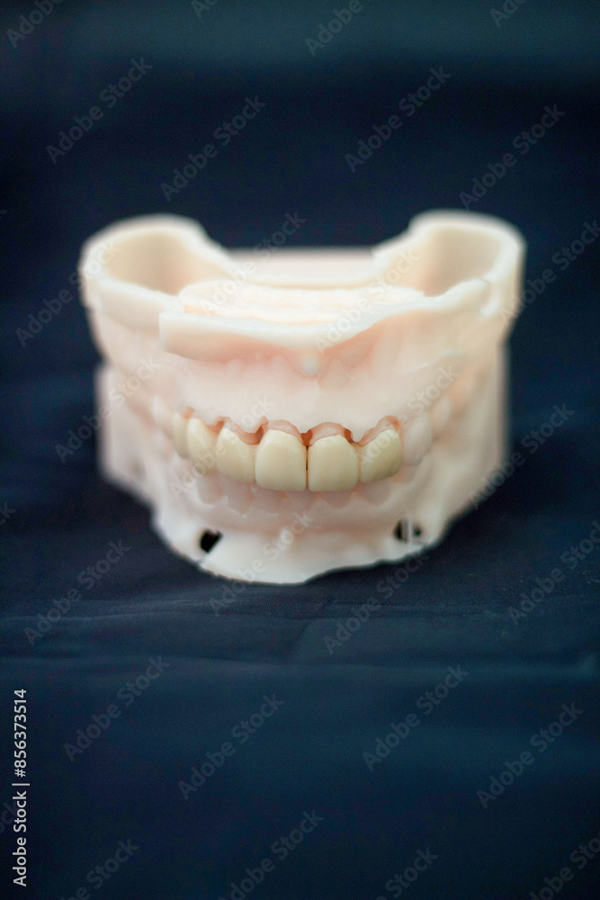 Fototapeta premium teeth treatment