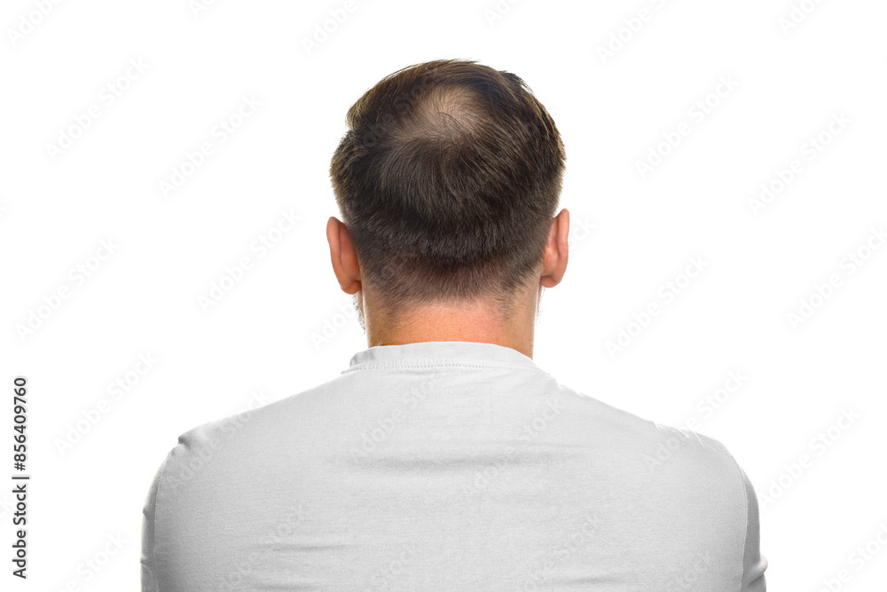 Baldness concept. Man with bald spot on white background, back view Baldness concept. Man with bald spot on white background, back view