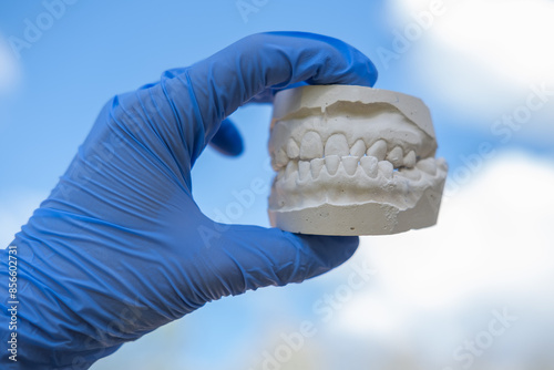 White plaster impression of the dental jaw of a patient with crooked teeth and malocclusion. Manufacturing of dentures and crowns based on orthodontic impressions photo