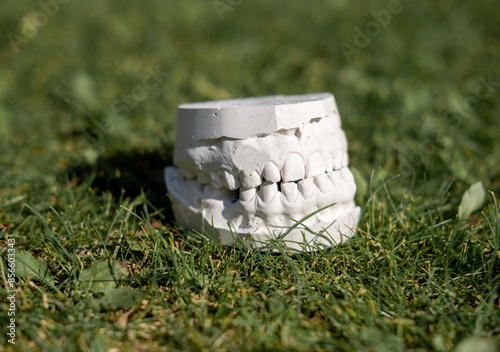 White plaster impression of the dental jaw of a patient with crooked teeth and malocclusion. Manufacturing of dentures and crowns based on orthodontic impressions photo