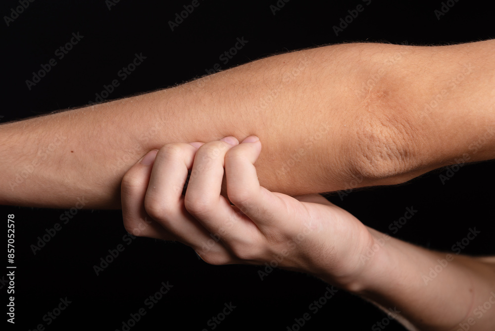 Young man scratching his arm with his hand. Skin disease. Irritation, allergy. Young man scratching his arm with his hand. Skin disease. Irritation, allergy.