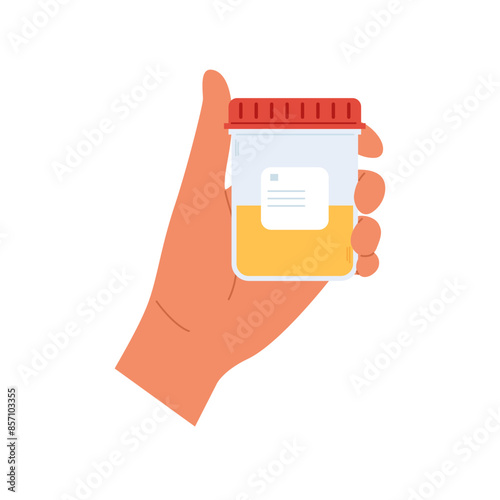 Urine analysis. Hand holds container with urine sample. Plastic containers with biomaterial