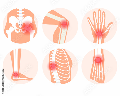 joint pain in human body knee spine and other joint pain arthritis facture