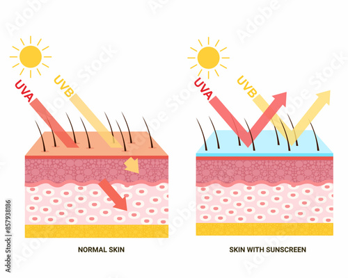 before and after Appling sunscreen Human skin protection from ultraviolet rays effect