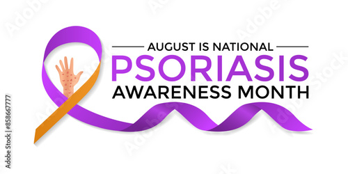 Vector illustration of Psoriasis awareness month is observed every year in August. Banner design template.