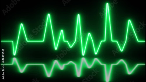 ECG with supraventricular premature beats and short paroxysms of neon atrial fibrillation animation.
 photo