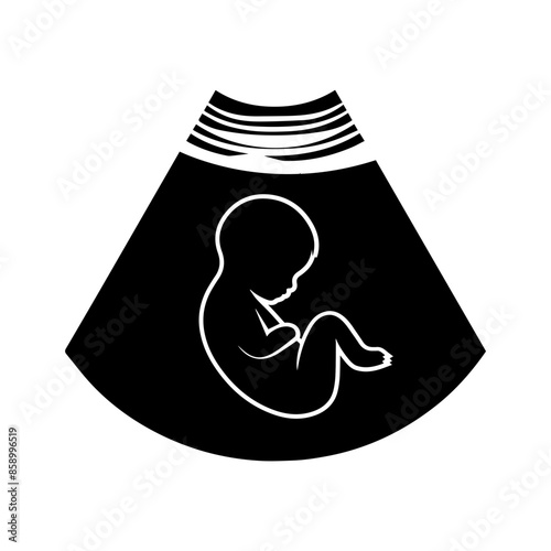 Baby Sonogram Diagram Clipart