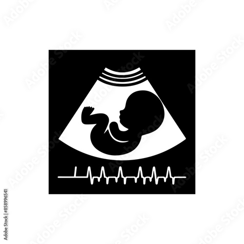Baby Sonogram Diagram Clipart